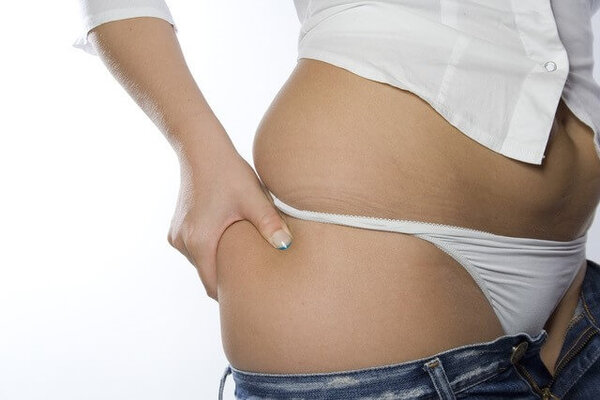 Frau kneift in Bauchfett, Thema Körperbewusstsein, Abnehmen und Fettabbau illustriert.